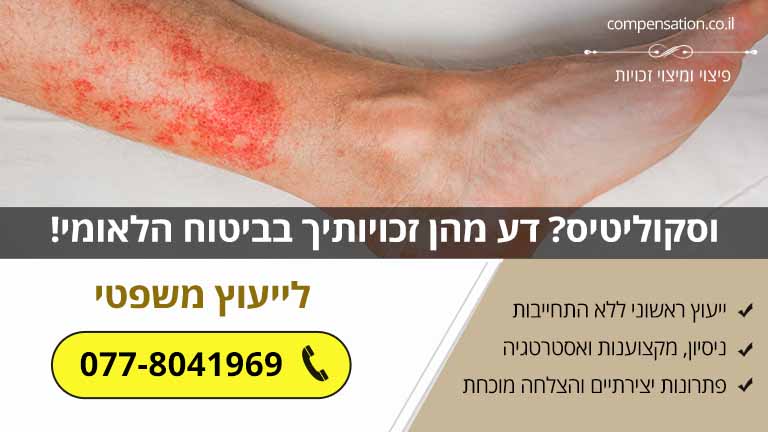 וסקוליטיס? דע מהן זכויותיך בביטוח הלאומי!